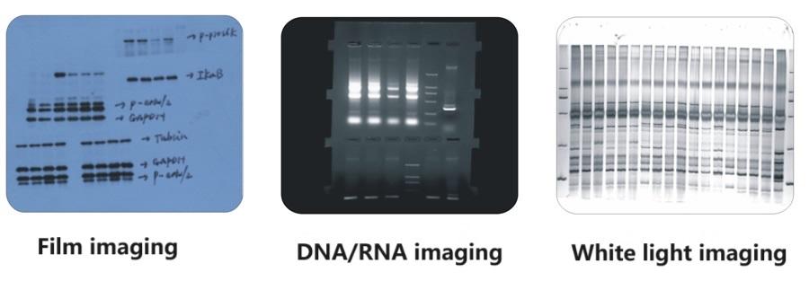 Systèmes d'imagerie de documentation sur gel